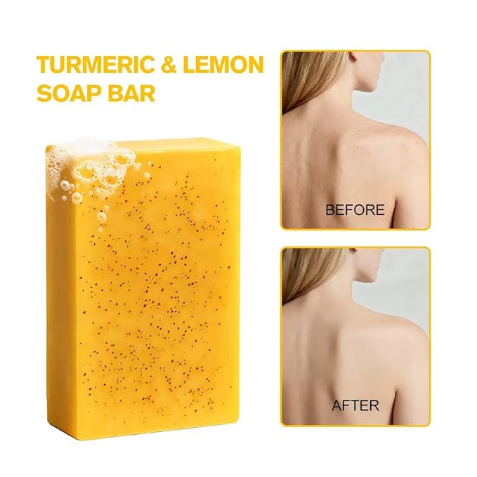 Kojic Acid & Turmeric Soap, Turmeric Kojic Acid Soap for Face and Body, Organic Daily Use Skin Care Soaps, Gentle Cleansing Suitable for All Skin Types (2pcs)