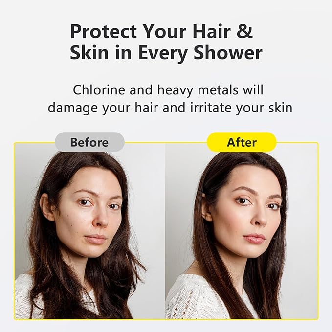 Next-Gen Shower Filter - SoliCozy Shower Water Filter, Water Softener Shower Head Filter, Reduces Dry Itchy Skin, Dandruff, Eczema, and Dramatically Improves The Condition of Your Skin, Hair and Nails