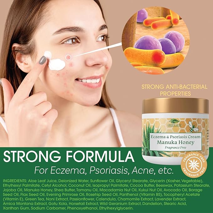Manuka Honey Eczema Cream Moisturizing Lotion Fragrance Free For Psoriasis Relief - Itchy, Dry Skin Rash Ointment - Skin Soothing Moisturizer - Body & Face Cream - Kids & Adults 8oz